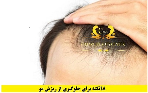 روش های درمان ریزش مو