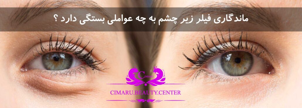 ماندگاری فیلر بینی